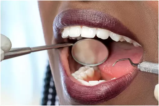 gum disease deep cleaning