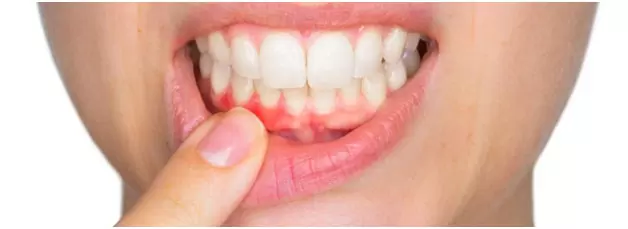 Preventive Dentistry