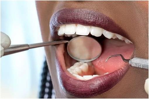 Gum disease deep cleaning treatment at Regatta Dental Centre, Richmond Hill